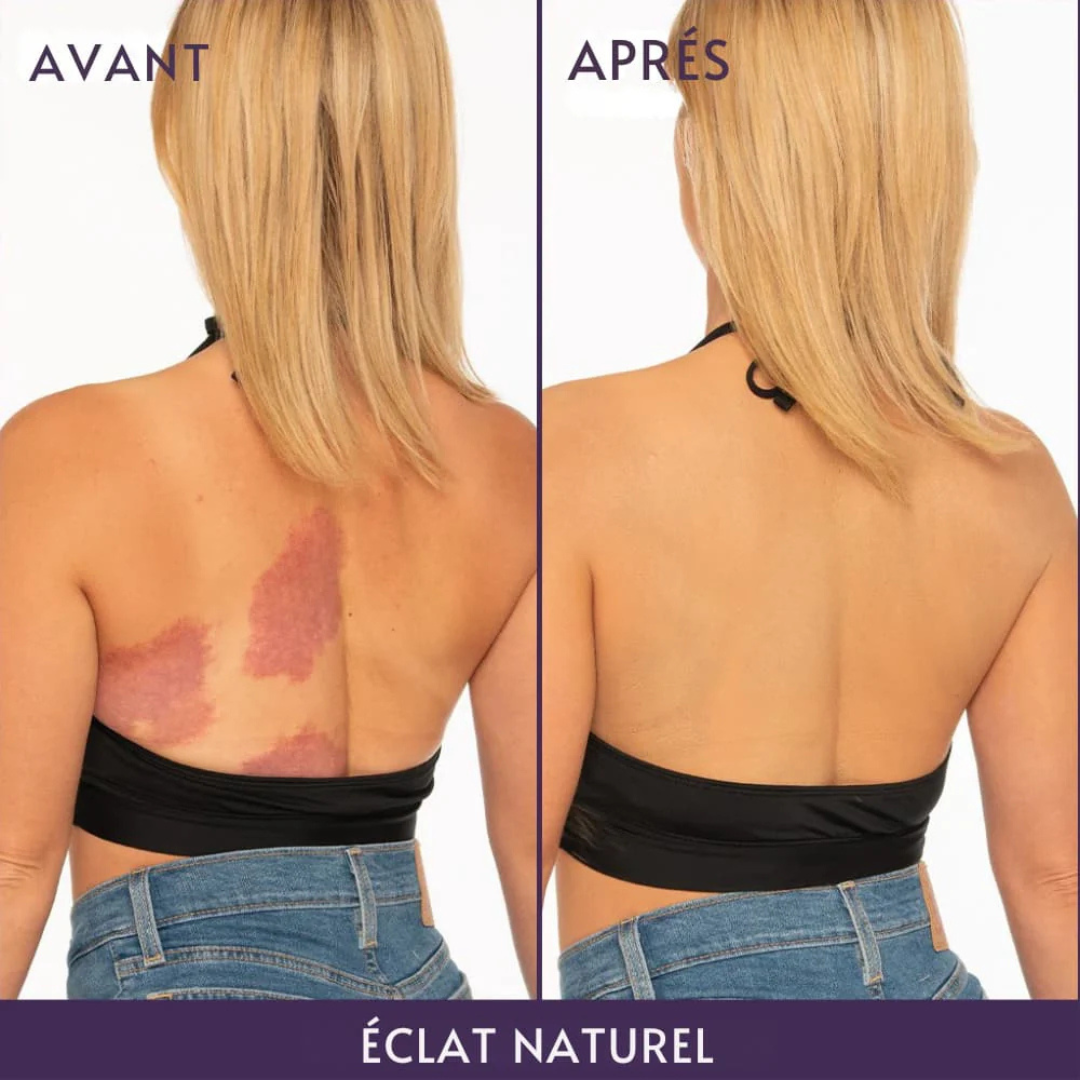 Myskin - Perfecteur pour le corps "Pour une peau parfaite"