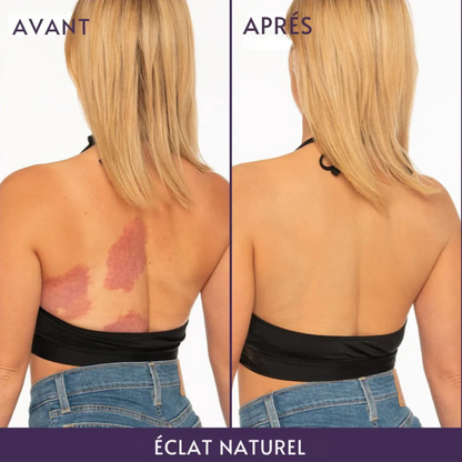 Myskin - Perfecteur pour le corps "Pour une peau parfaite"